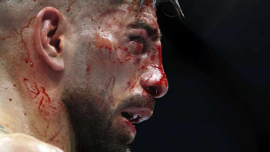 Ilia Topuria's Face Was Unrecognizable as Justin Gaethje Wins Upset TKO at UFC White House 