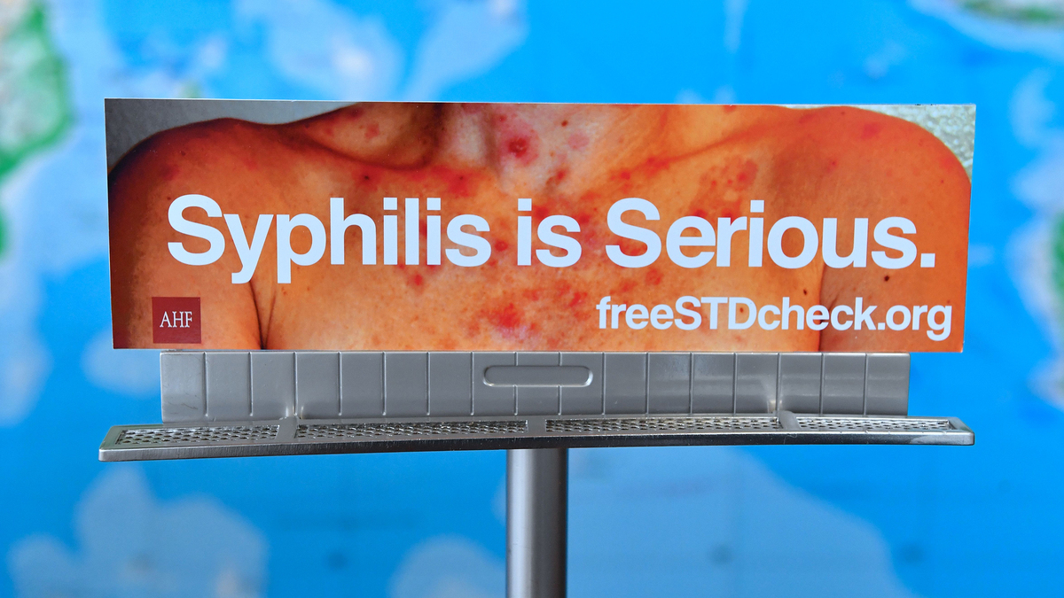 A model of a billboard from the AIDS Healthcare Foundation (AHF) which ran in Los Angeles earlier this year but has been rejected to be displayed in many other cities is seen at the AHF office in Hollywood, California on May 18, 2018. (Frederic J. Brown/AFP via Getty Images/TNS)