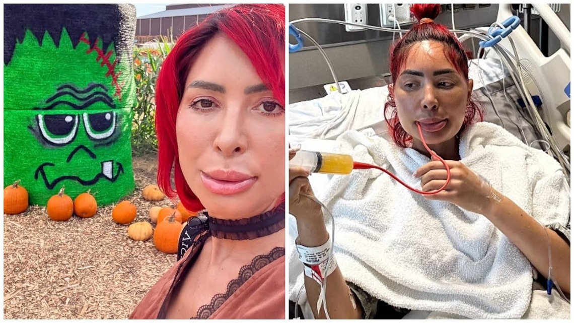 ‘Teen Mom' Alum Farrah Abraham Shares Update After Jaw Surgery: 'I Feel Like Frankenstein' 