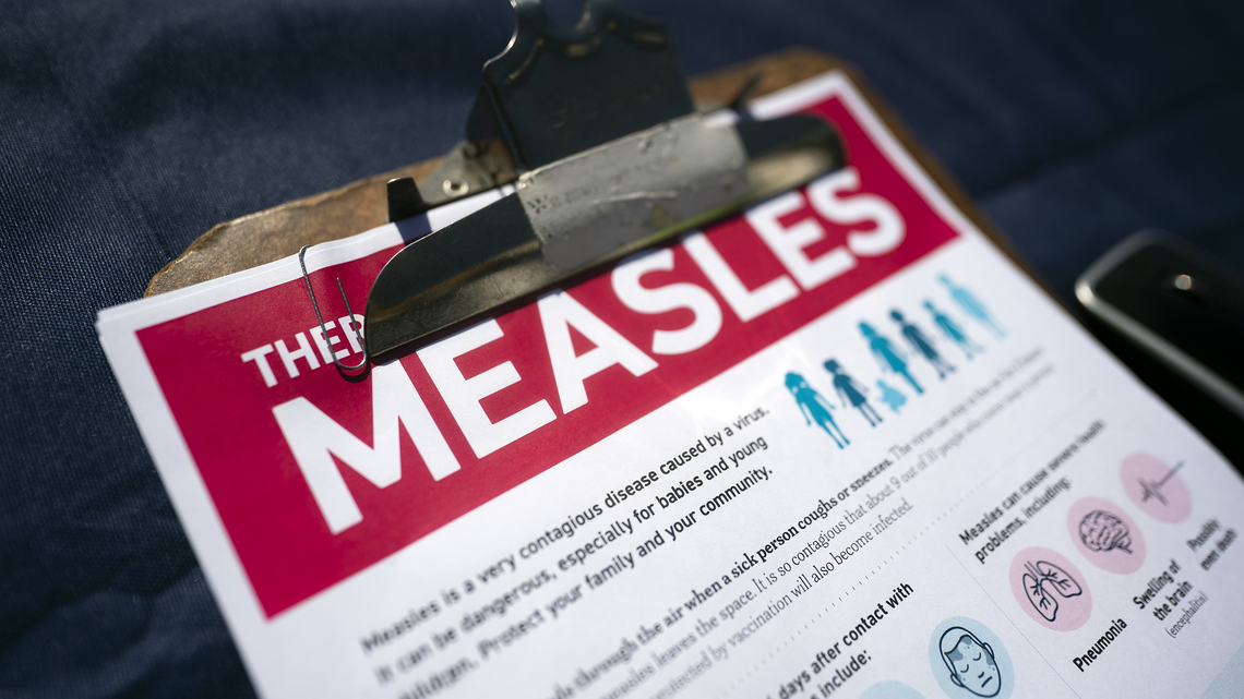 Commentary: The measles outbreak is evidence of a broken system 