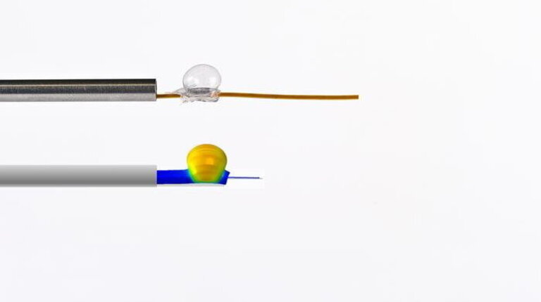 Tiny probe monitors unborn baby's health inside womb during surgery