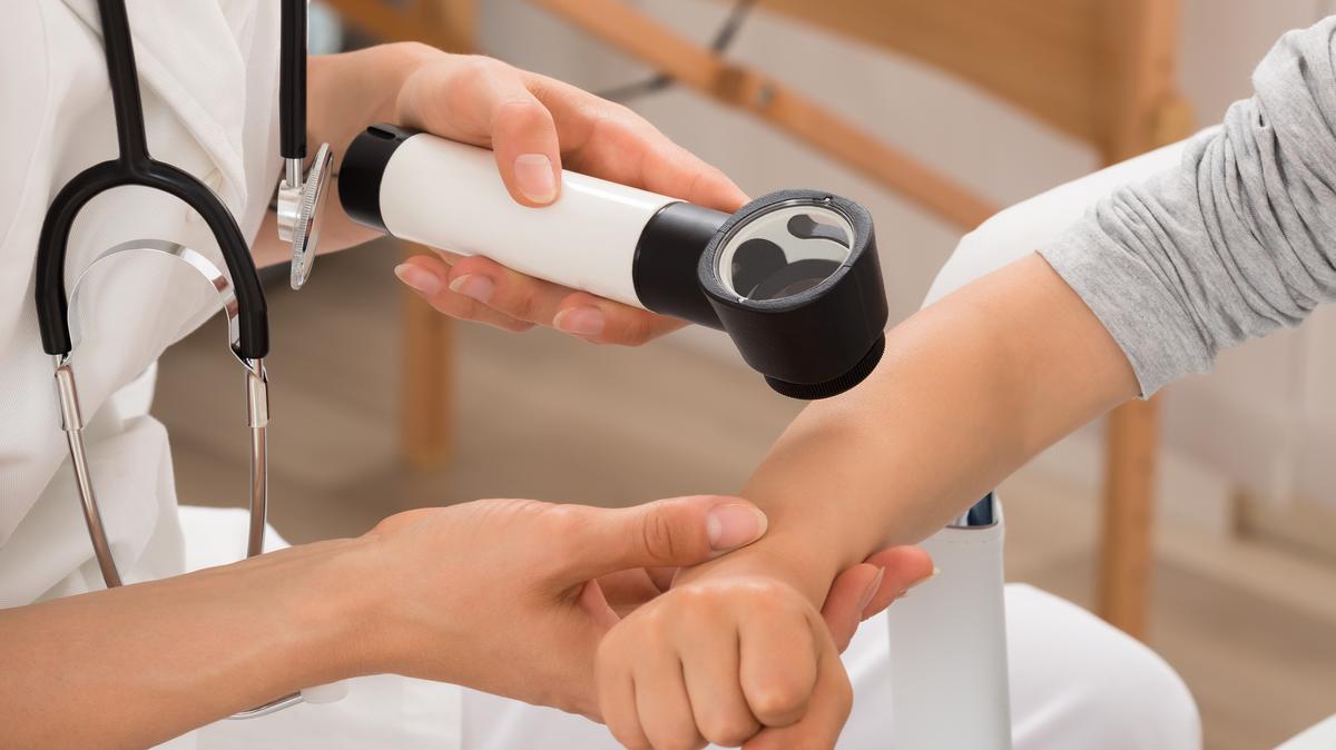 Melanoma is a type of skin cancer that begins in melanocytes, which are the pigment-producing cells. (Andrey Popov/Dreamstime/TNS)