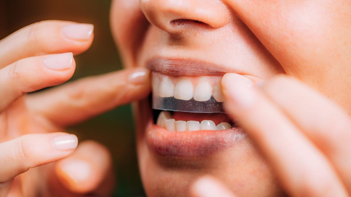 Amazon Shoppers Swear They Saw a 'Pretty Big Difference' After Using These Whitening Strips 