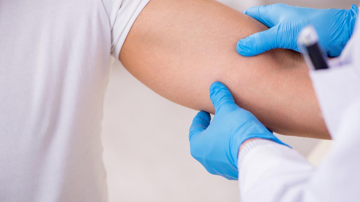 A new campaign is calling on more doctors, particularly in states like Florida with high rates of skin cancer, to use dermatoscopes for all skin exams. The small, handheld device visualizes structures beneath the skin’s surface and can help detect early melanomas. (Dreamstime/TNS)