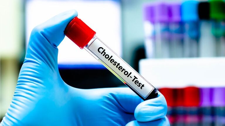 An Age-by-Age Guide to Cholesterol Levels, Good and the Bad