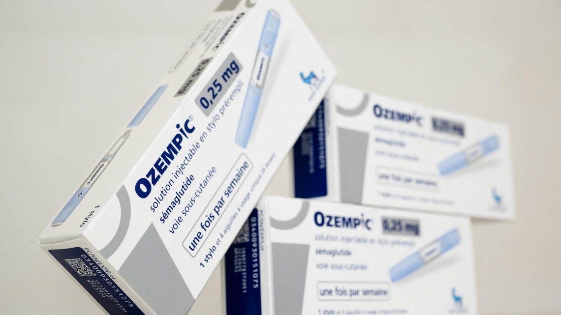 What Is Temporal Wasting? The Overlooked Ozempic Face Symptom Doctors Want You to Know