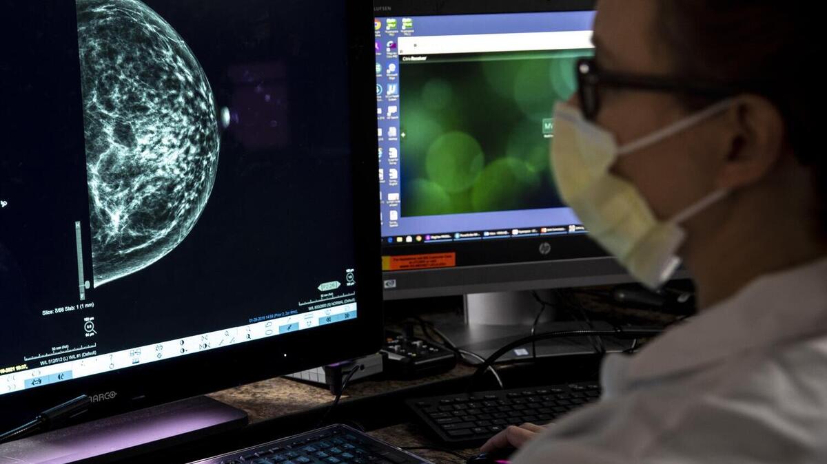 Westwood, CA - May 11: Dr. Hannah Milch, assistant clinical professor, Department of Radiology at the David Geffen School of Medicine at UCLA in Westwood, CA, is photographed reviewing a mammogram Tuesday, May 11, 2021. (Jay L. Clendenin / Los Angeles Times)