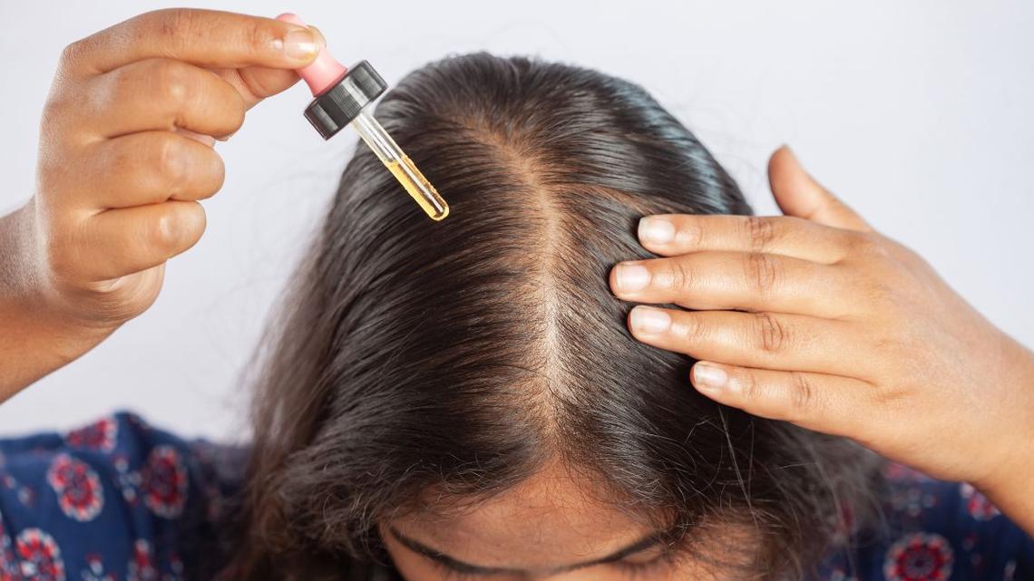 Is Minoxidil Covered by Insurance? How To Save Big on Hair Loss Treatment