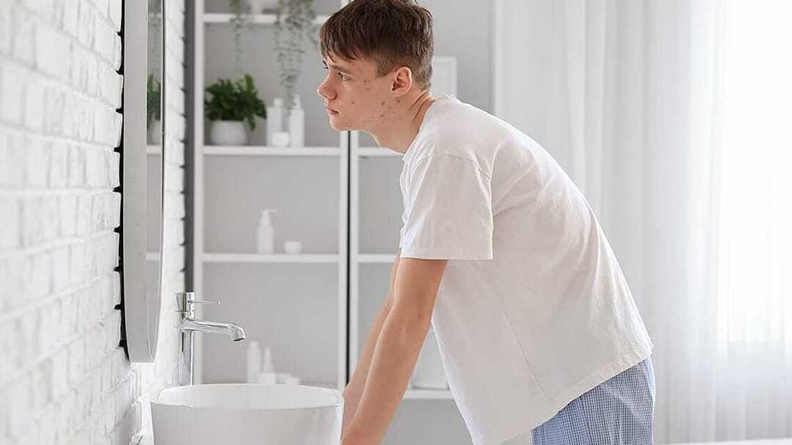 7 proven acne treatments for teens 