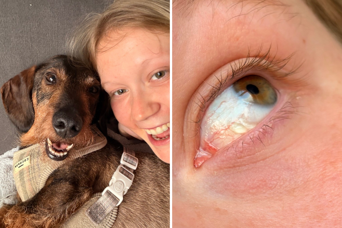  From left: Alabama Jackson with Goober, and the blister forming in her eye. 