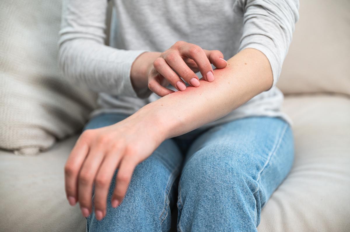 Itchy bug bite.