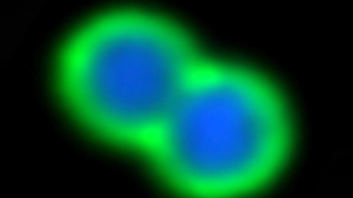 A strain of Neisseria gonorrhoeae stained with a monoclonal antibody. (Rino Rappuoli via SWNS). 
