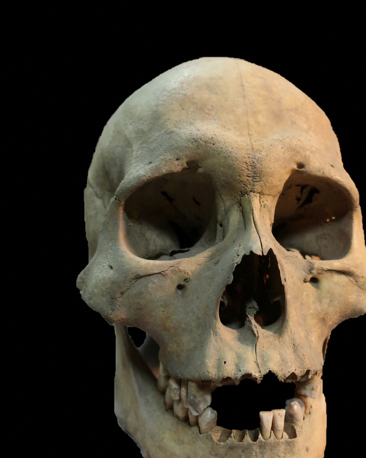 The skull of a hunter-gatherer woman estimated to have been 25-35 years old who was found to have been infected with plague and was buried in a grave excavated in the vicinity of Lake Baikal in Siberia dating to roughly 5,500 years ago, seen in this undated photograph released on June 17, 2026.  Angela Lieverse/Handout via REUTERS