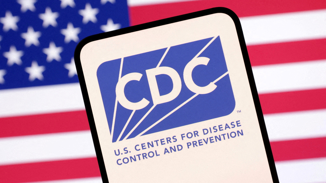 US cyclosporiasis cases top 4,100 as CDC investigates lettuce-linked outbreak 
