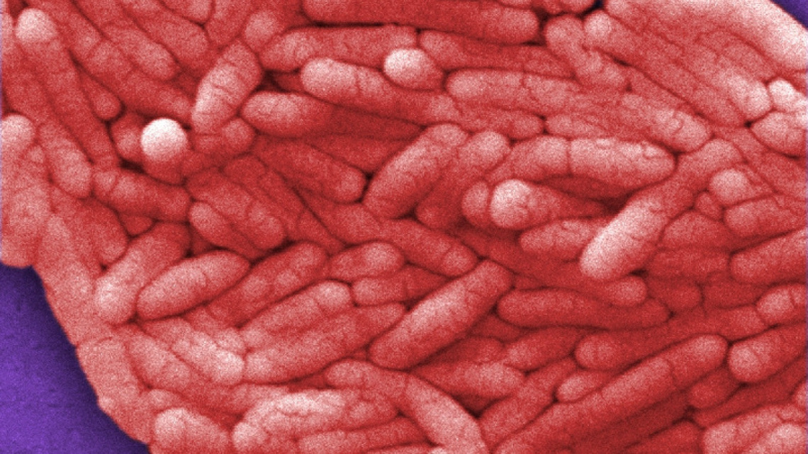 Grocery store produce linked to stomach illness in Washington state. What to know