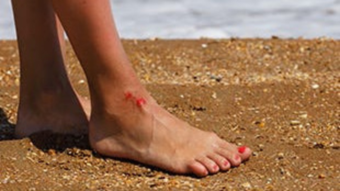 Florida reports 3rd Vibrio vulnificus death in latest update