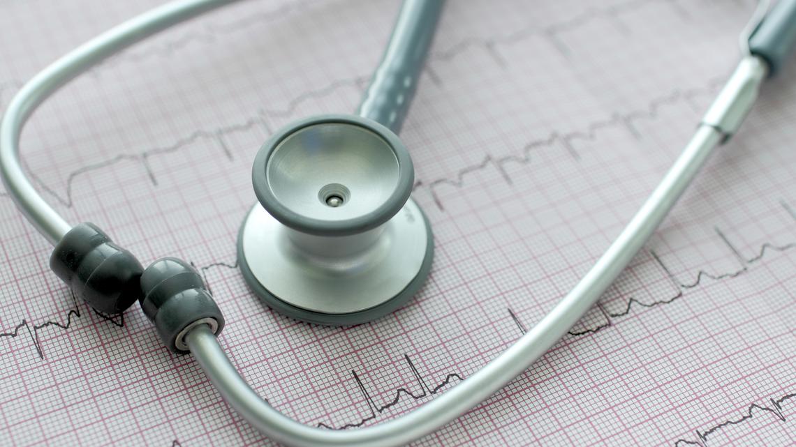 An abnormal heart rhythm is also known as an arrhythmia.