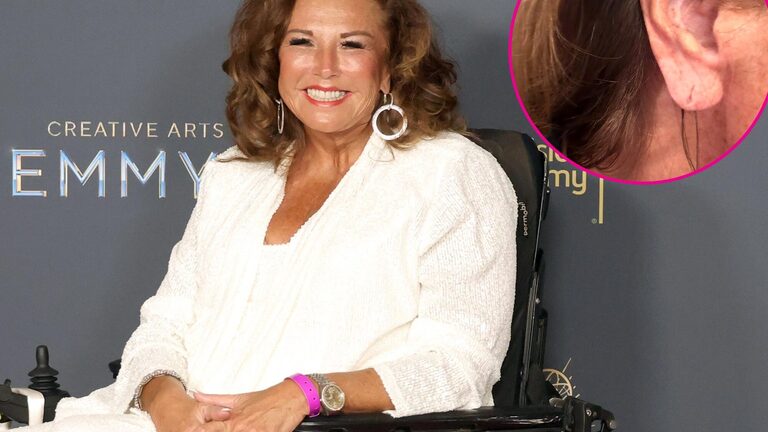 Abby Lee Miller Shows Off Results of $1K Ear Rejuvenation Procedure 