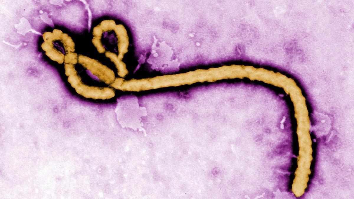 Congo Ebola. An image by the Centers for Disease Control and Prevention (CDC) shows an Ebola virus virion. 