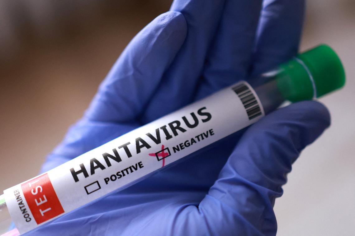 Hantavirus patients were being monitored in a GA hospital. Are you at risk?
