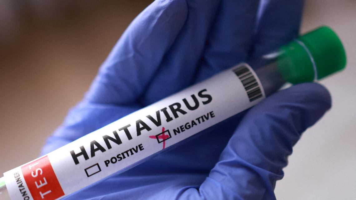Hantavirus patients are being monitored in a GA hospital. Are you at risk?