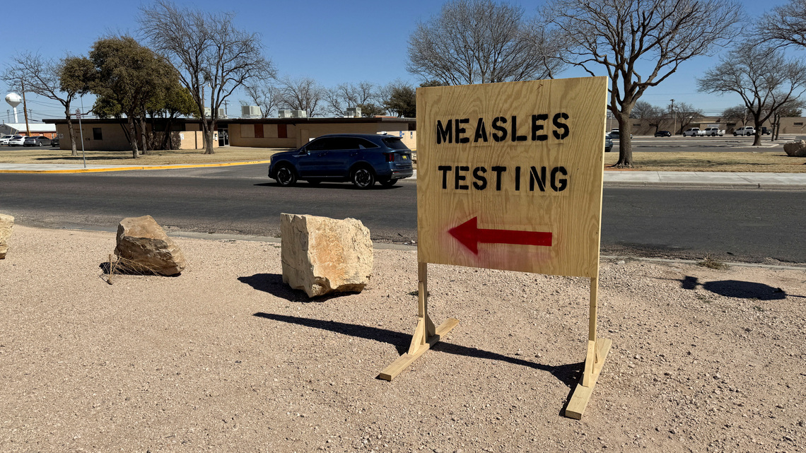 US CDC works on standard definition for measles deaths as cases rise 