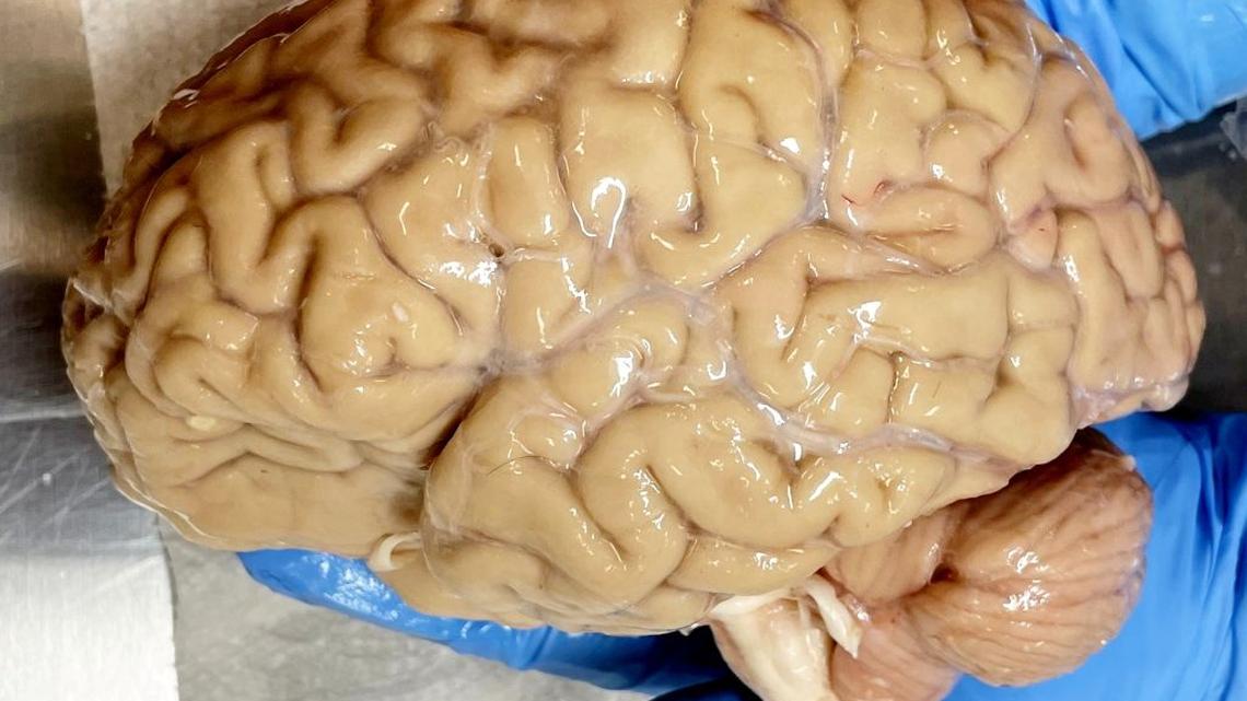 Would deep freezing humans like in sci-fi  actually work?