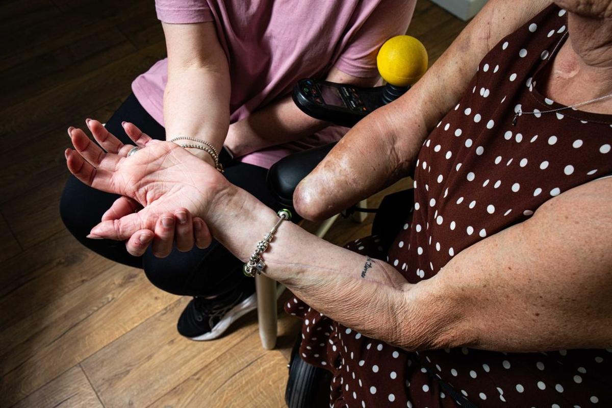 Kim Smith lost her limbs after contracting sepsis in 2017. (William Lailey via SWNS) 