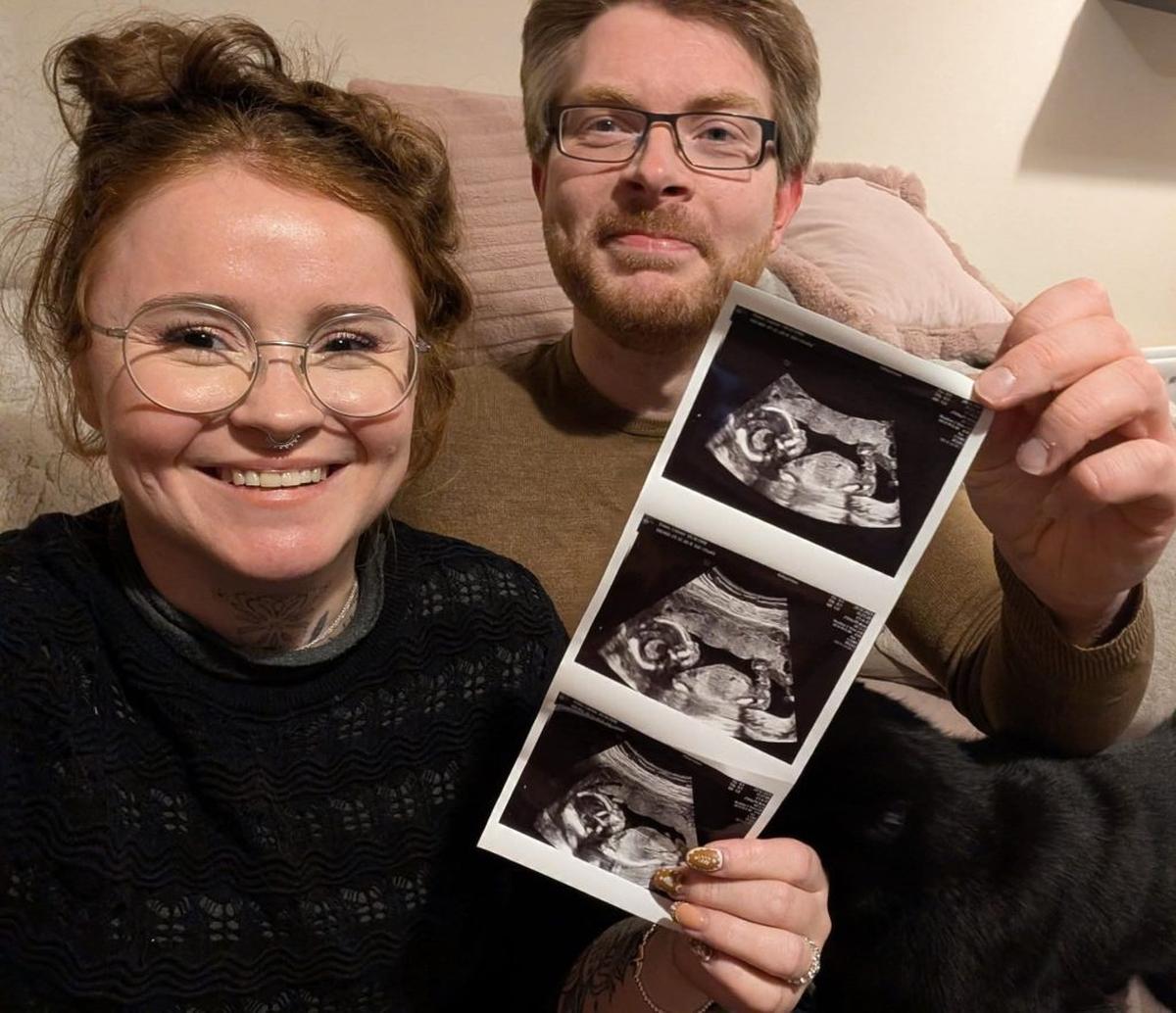  Stephen Whyte, Lauren Evans, with the baby scan of Ambrose Attenborough Whyte. (Stephen Whyte via SWNS) 