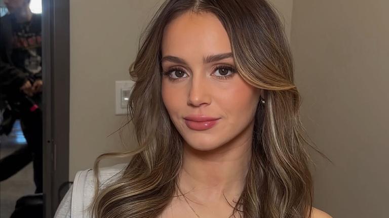 Mikayla Matthews Claps Back at People ‘Minimizing' Her Chronic Skin Condition 