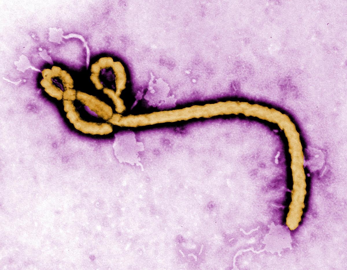  An image by the Centers for Disease Control and Prevention (CDC) shows an Ebola virus virion. 