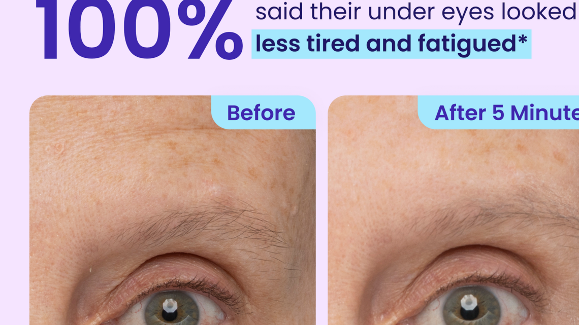 Aging Around the Eyes? This Viral Skincare Find Tightens Sagging Skin 