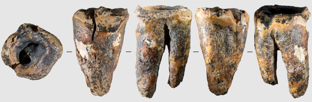  Chagyrskaya 64 molar tooth and its macro-features: View of the tooth in five projections. (Zubova et al. 2026 via SWNS) 