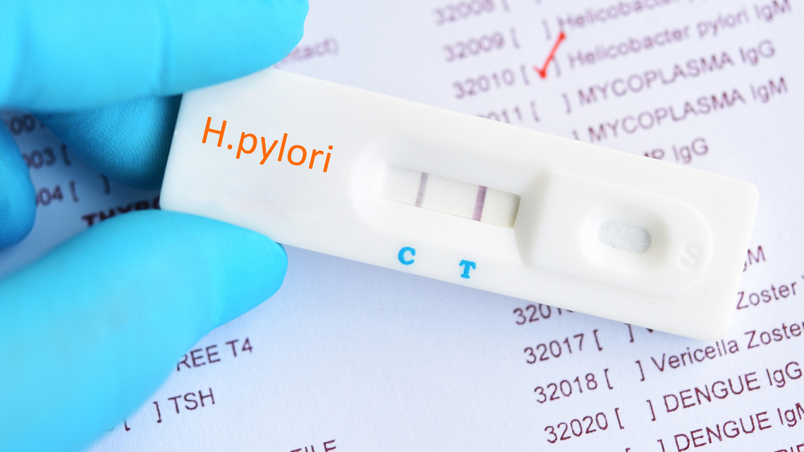 H. pylori linked to 1 in 5 bowel cancer cases, study finds