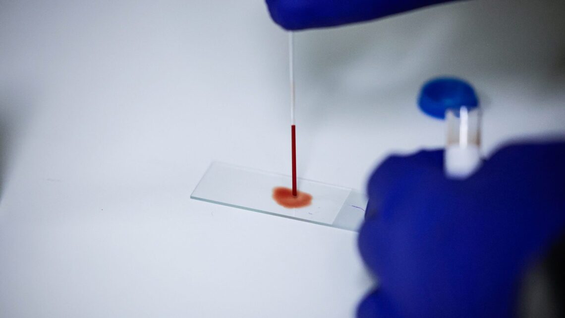 New Studies Found Your Blood May Hold Surprising Anti-Aging Power 
