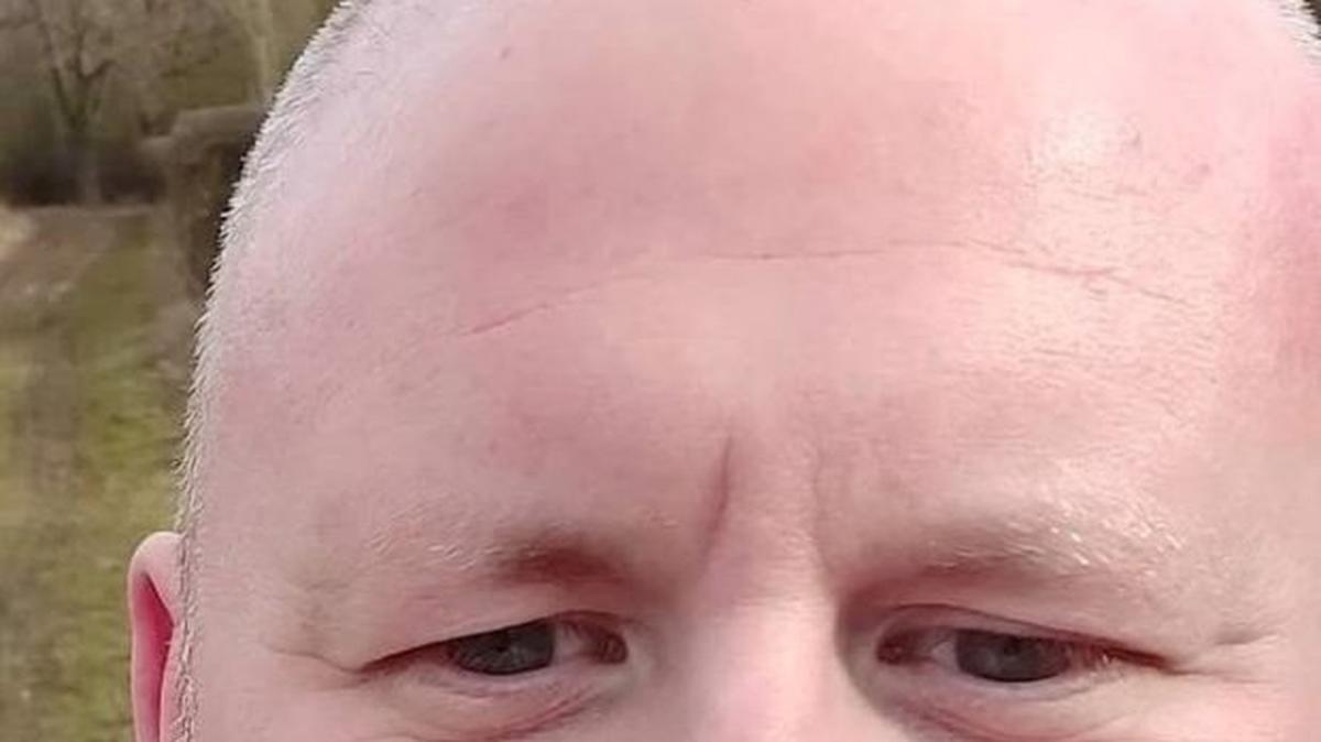 Simon Pearson, 41, was repeatedly treated after doctors misdiagnosed him following complaints of extreme tiredness. (Irwin Mitchell via SWNS). 