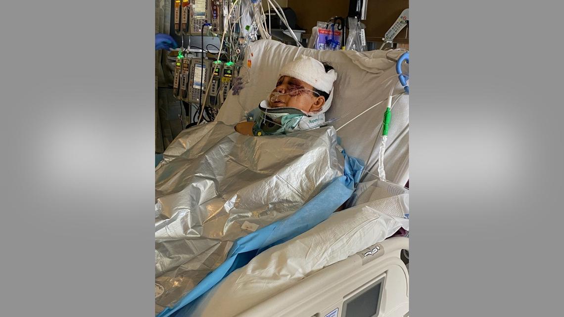 Colorado Woman Left in Critical Condition After Being Attacked By 3 Dogs 