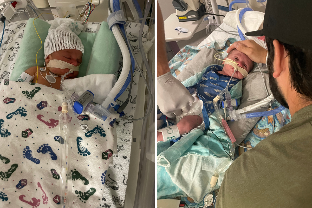  From left: Nolan lies as a newborn, hooked up to machines with a feeding tube connected to his nose; and his dad touches his head. 