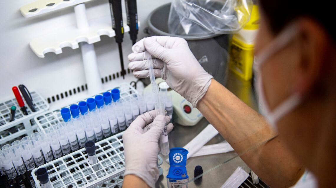Russian authorities: Lab technician in Siberia did not die of plague