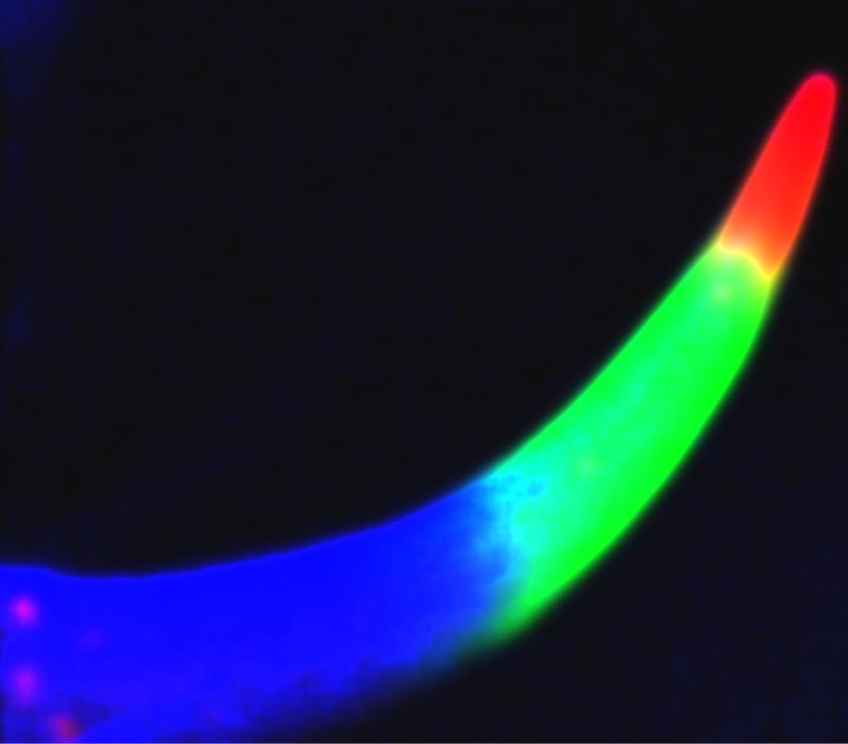  Micro X-ray fluorescence microscopy of the metals present the stinger of a scorpion. (E.P. Vicenzi/Smithsonian Museum Conservation Institute and NIST via SWNS) 