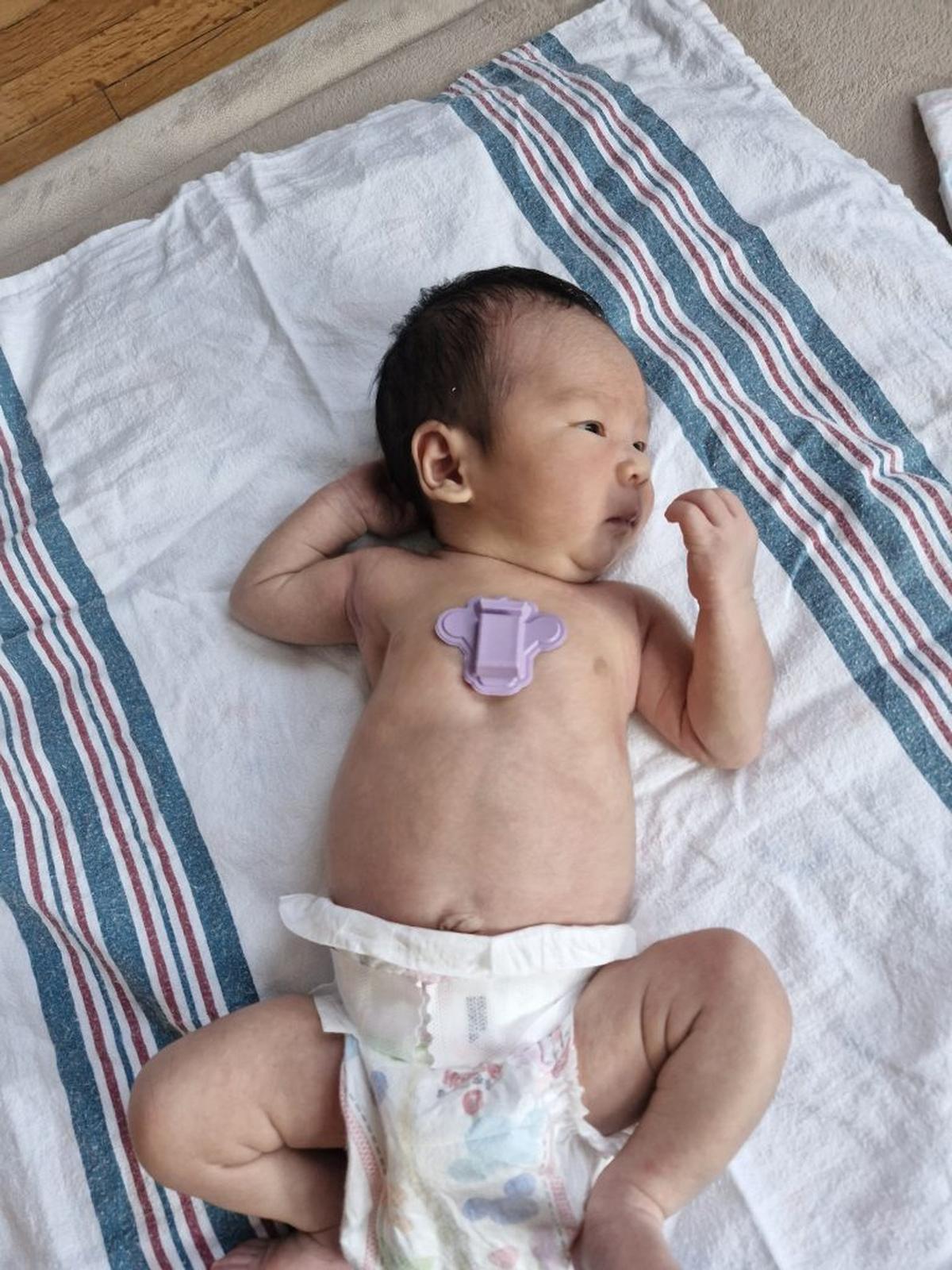  By continuously monitoring physiological signs of stress, the device can detect underlying stress in individuals, including babies, who cannot communicate. (John A. Rogers / Northwestern University via SWNS) 