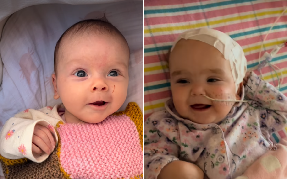  Audrey Tunks before and after her diagnosis. 