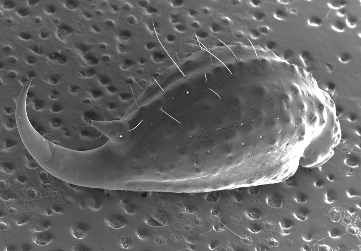  SE micrograph of the entire telson (stinger) of the Tanzanian red bark scorpion (Babycurus Jacksoni). Image includes the telson vesicle, in which the two venom producing glands can be found. Muscles surrounding the glands will contract internally, pushing venom up through conduits to the tip of the telson (termed the aculeus). This species also features a subaculear tubercle (small protrusion above the stinger) with an unknown function. (Sam Campbell / University of Queensland via SWNS) 