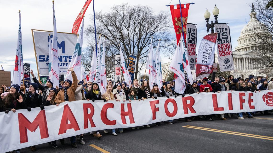 Abortion laws show that public policy doesn't always line up with public opinion 