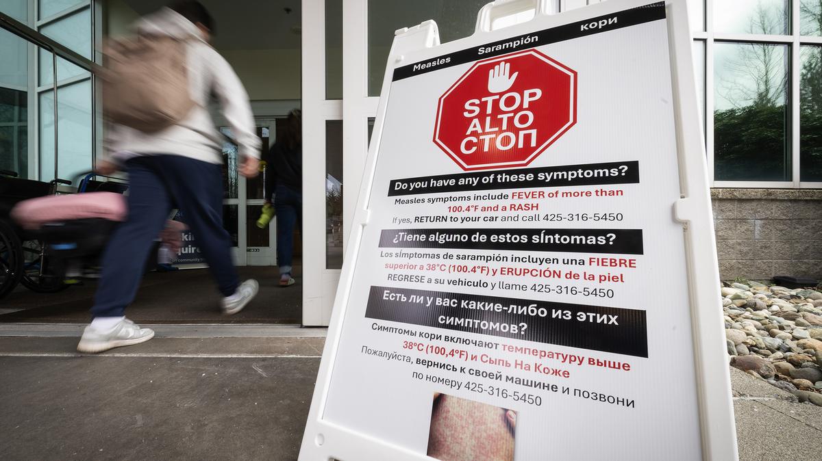 A sign warns people not to enter a Providence walk-in clinic with measles symptoms on Feb. 26, 2026, in Everett, Washington. It includes a small photo at the bottom showing measles. (Ken Lambert/The Seattle Times/TNS)