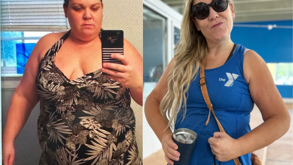 ‘I Lost 150 Pounds With the Help of a Natural GLP-1' 