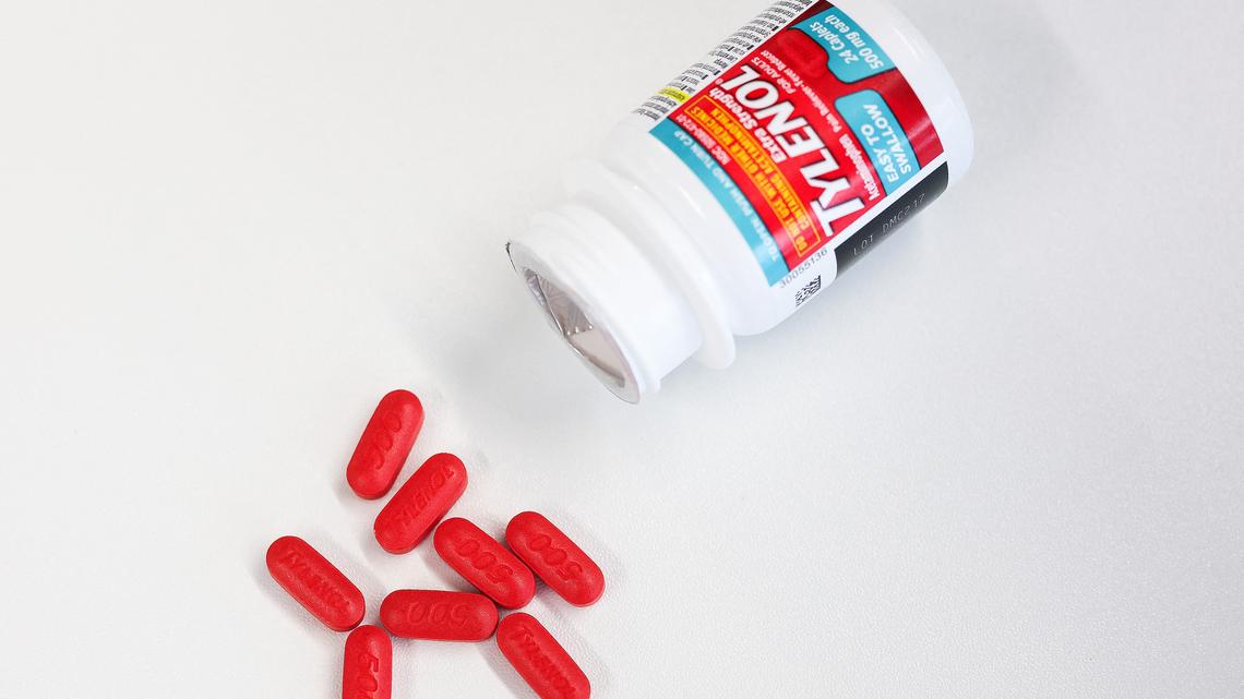 New medical guidance affirms Tylenol safety during pregnancy months after Trump sows doubt 