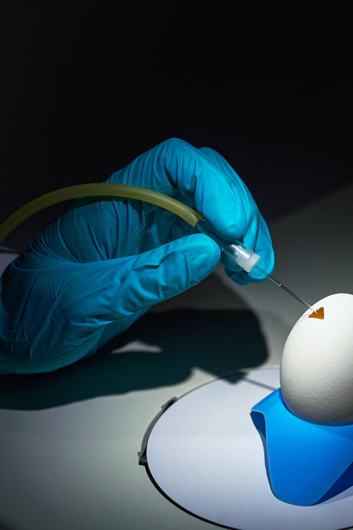 An undated image by Marco Figueroa/Neion Bio of a chicken egg at the biotech start-up receiving a microinjection. Neion Bio is testing a novel way of efficiently producing pharmaceuticals by turning chicken eggs into drug factories -- genetically engineering birds to produce medical compounds. (Marco Figueroa/Neion Bio via The New York Times) -- NO SALES; FOR EDITORIAL USE ONLY WITH SCI DRUGS FROM EGGS BY CARL ZIMMER FOR APRIL 20, 2026. ALL OTHER USE PROHIBITED --