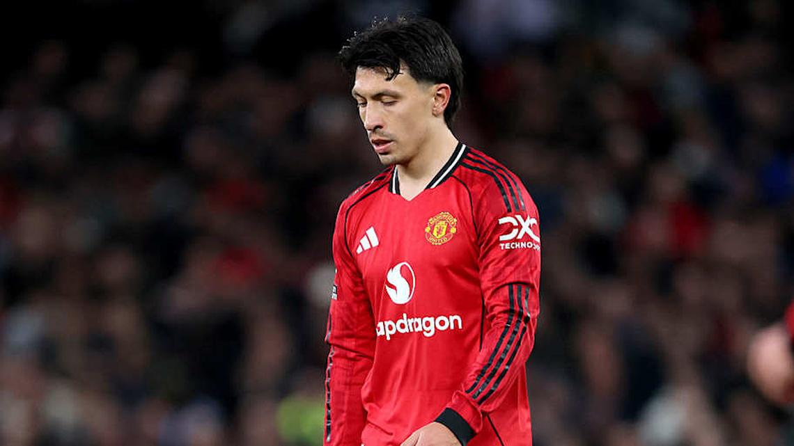  Lisandro Martínez was sent off for pulling Dominic Calvert-Lewin's hair. | Richard Sellers/Sportsphoto/Allstar/Getty Images 