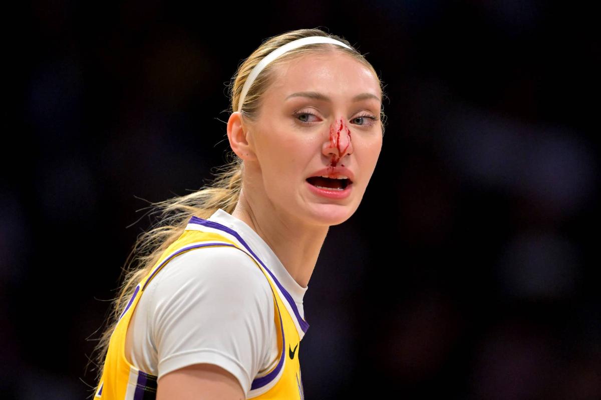  Los Angeles Sparks forward Cameron Brink (22) left the Las Vegas Aces game with a bloody nose. Jayne Kamin-Oncea-Imagn Images
